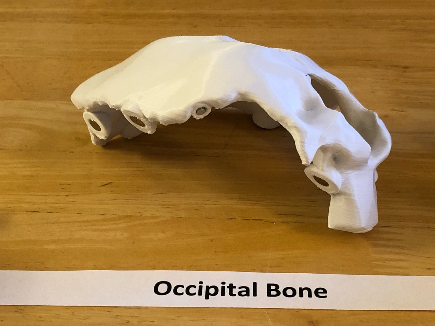 Craneo Humano Tamaño Real Anatomico